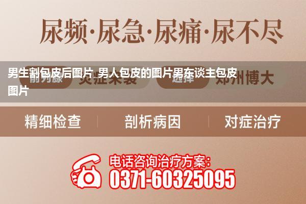 男生割包皮后图片_男人包皮的图片男东谈主包皮图片
