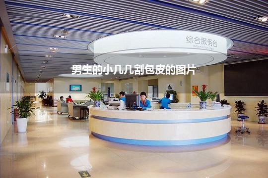 男生的小几几割包皮的图片