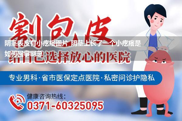 阴茎表皮有小疙瘩图片_阴茎上长了一个小疙瘩是如何回事啊急