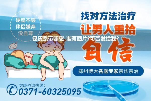 包皮系带断裂-谁有图片?可否发给我?