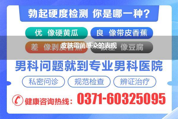 皮肤霉菌感染的表现