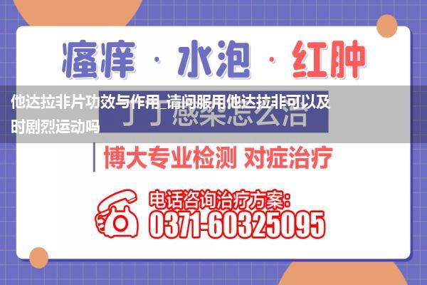 他达拉非片功效与作用_请问服用他达拉非可以及时剧烈运动吗