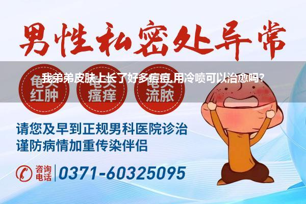 我弟弟皮肤上长了好多痘痘,用冷喷可以治愈吗?